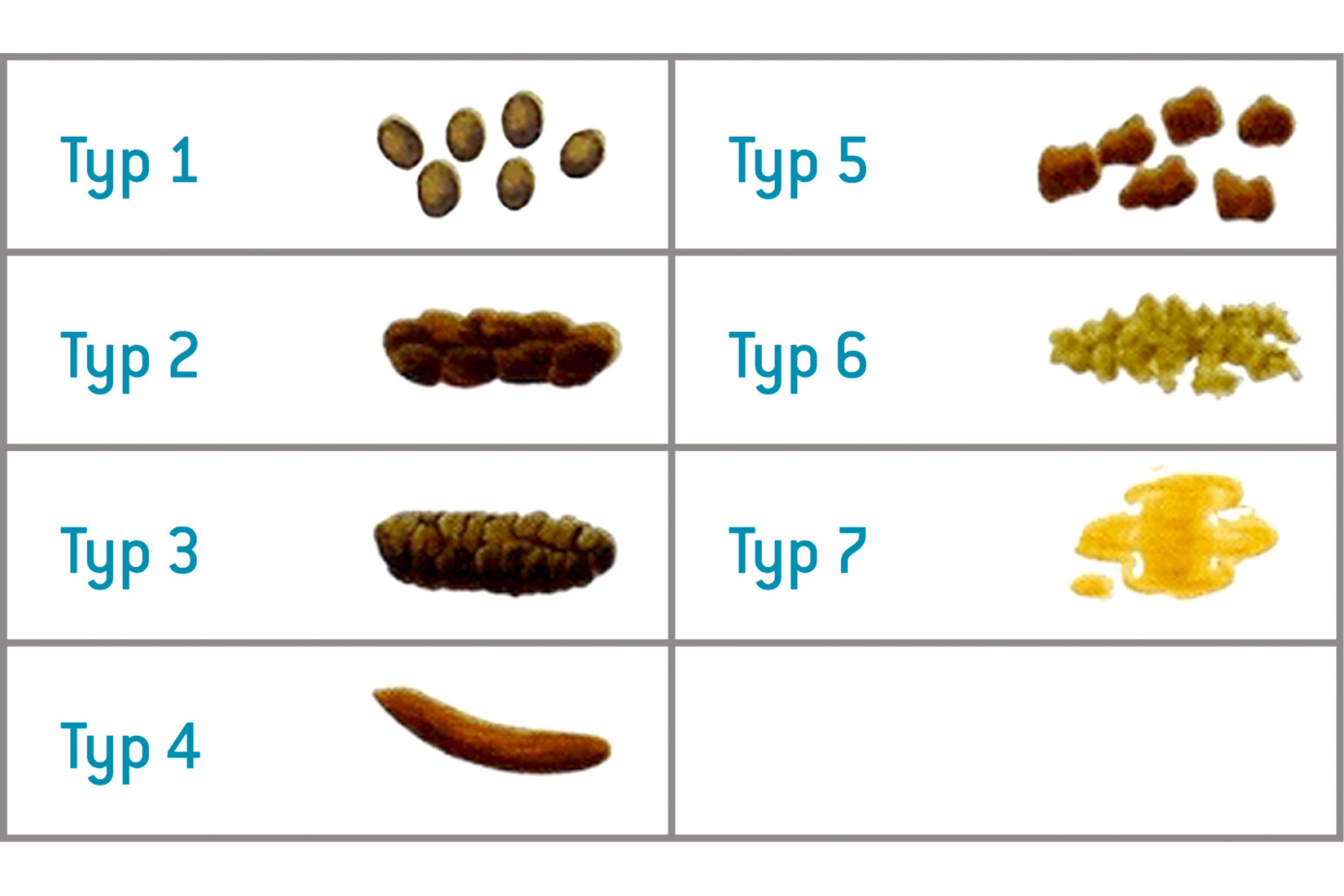 elfbar elfa kaufen Il giusto colore delle feci: qual è quello sano? main image 0
