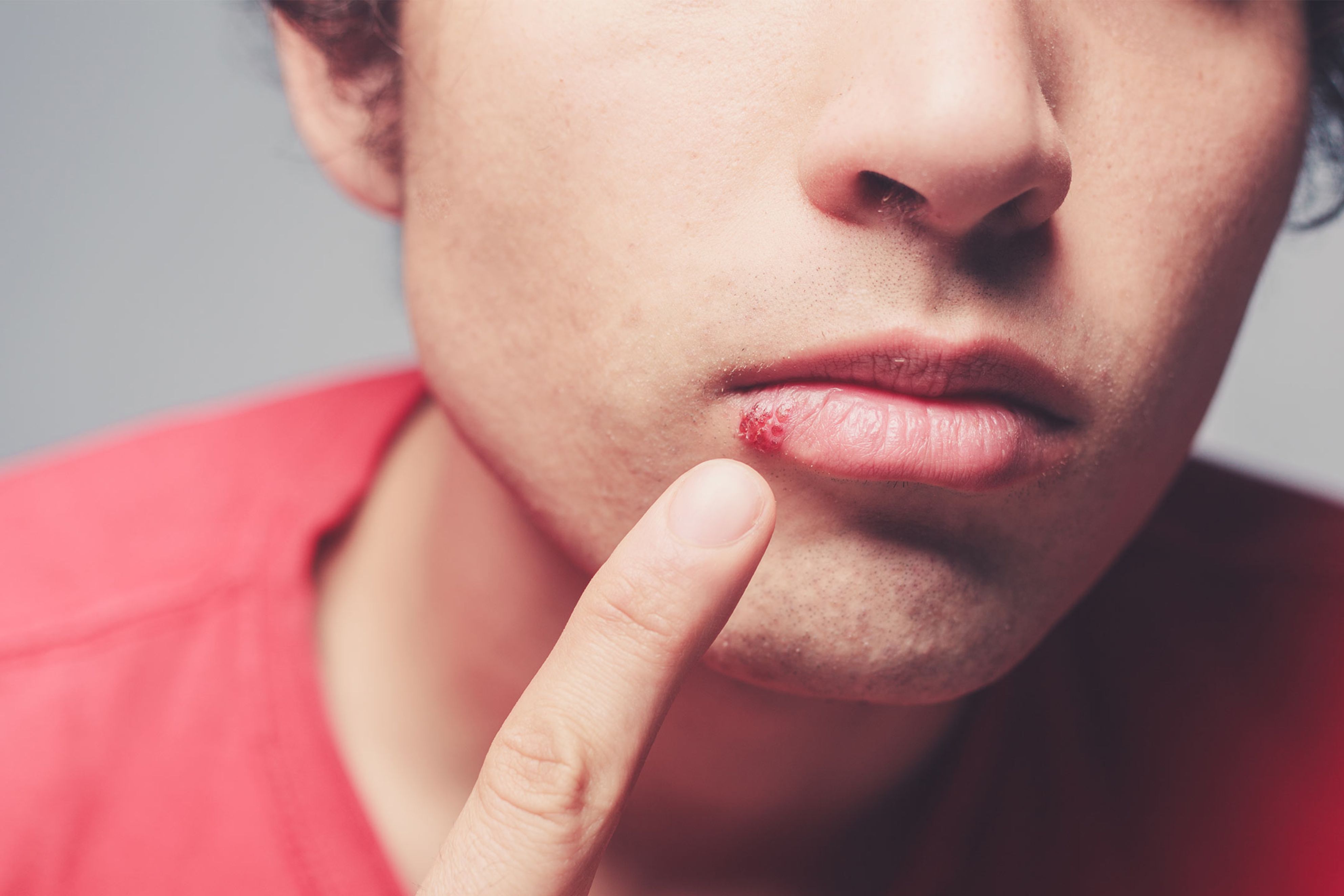 Impfung gegen Gürtelrose (Herpes Zoster) | Migros iMpuls
