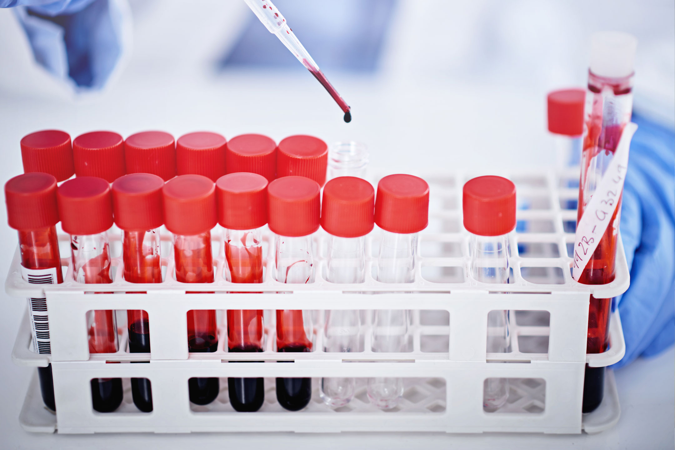 Blut Das verrät es uns & diese Aufgaben erfüllt es Migros iMpuls